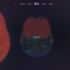 ‘Your Brain on Poker’: le attività cerebrali dei players durante il gioco!